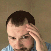 Hairvolumely® Ansatzpuder