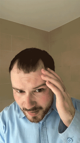 Hairvolumely® Ansatzpuder