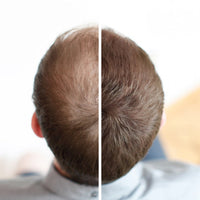 Hairvolumely® Streuhaar